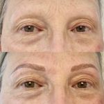 Dermopigmentation